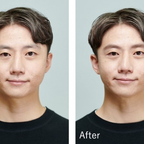 眉毛を整える前と後の違いを図解